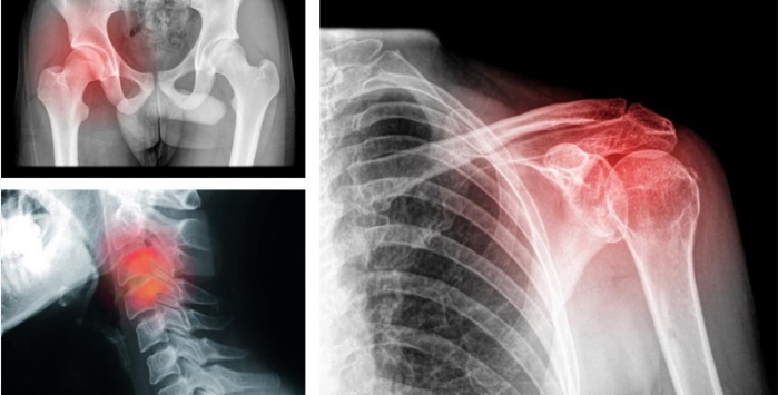 20170514_sinaisdedor_higherperspective