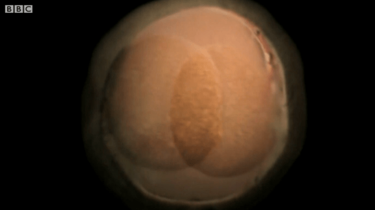 20171029_bbc_conceptiontobirth_httpwww.bbc.comfuturestory20120702-conception-to-birth-visualized