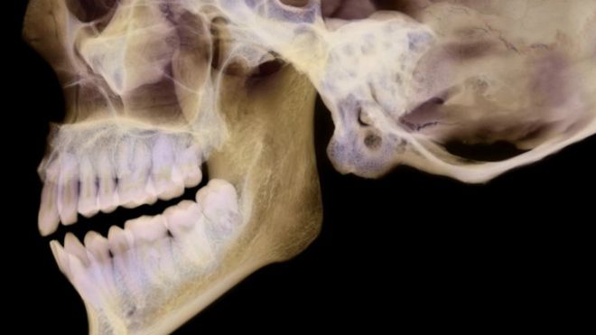 20171105_bbc_queixo_alamy_nocredit