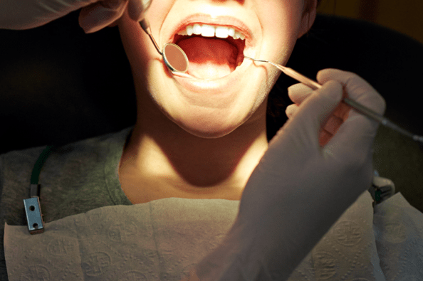 20180621_dentistas-cheiro_superinteressante